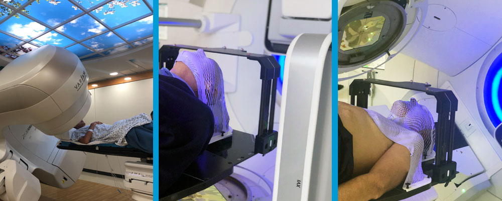 tecnicas radioterapia